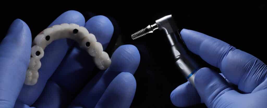 All-on-X implants vs. traditional dentures Omaha