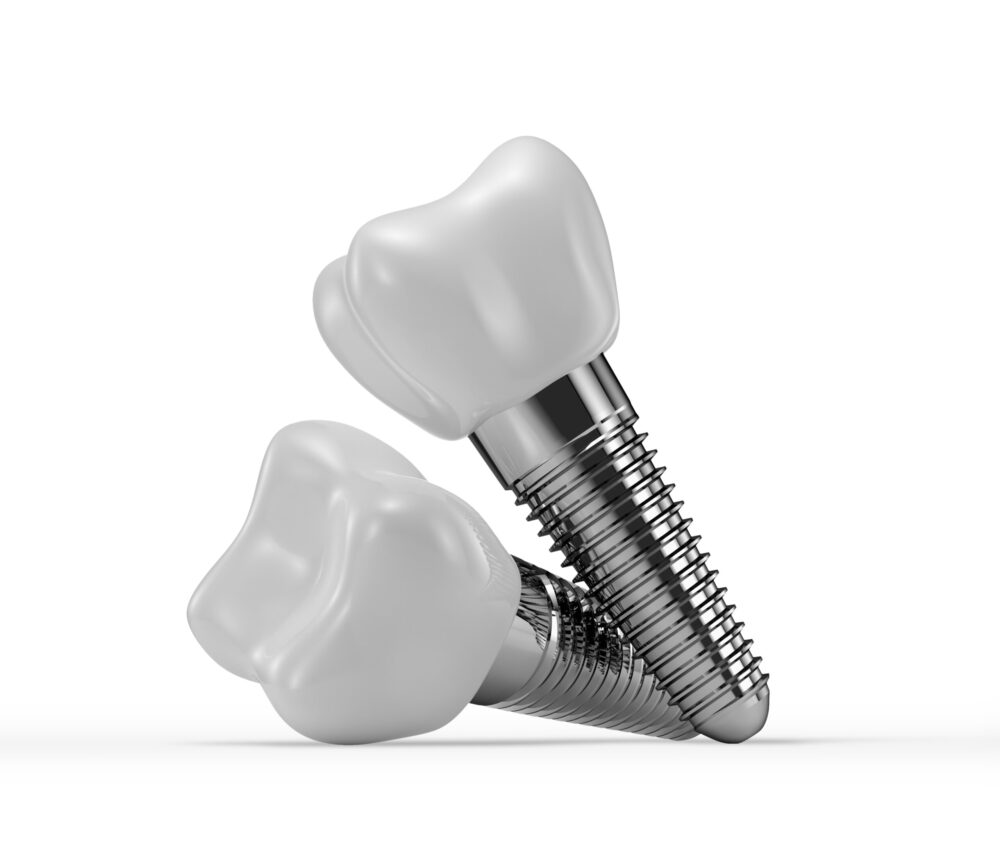 dental implants care